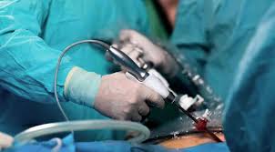 Laparoscopic Surgery